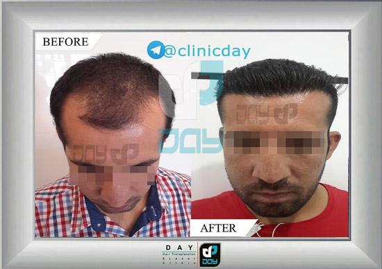 الصور عیادة الدی شیراز الصور عیادة الدی شیراز