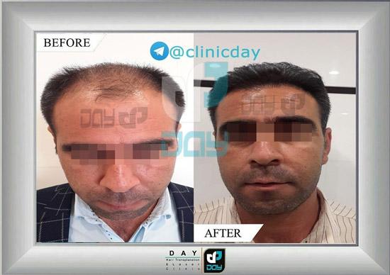 الصور عیادة الدی شیراز الصور عیادة الدی شیراز