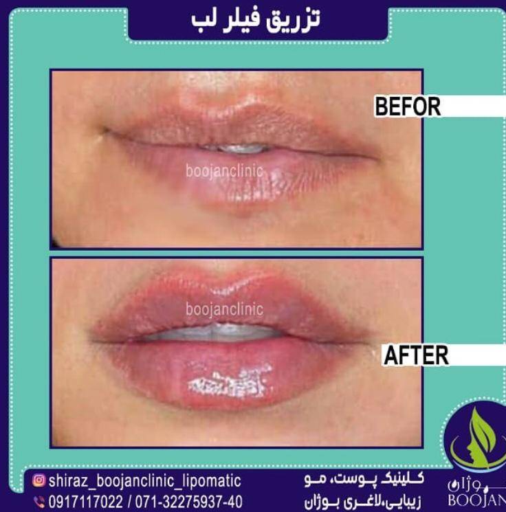 الصور عيادة بوجان شیراز الصور عيادة بوجان شیراز