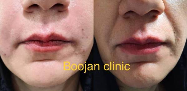 الصور عيادة بوجان شیراز الصور عيادة بوجان شیراز