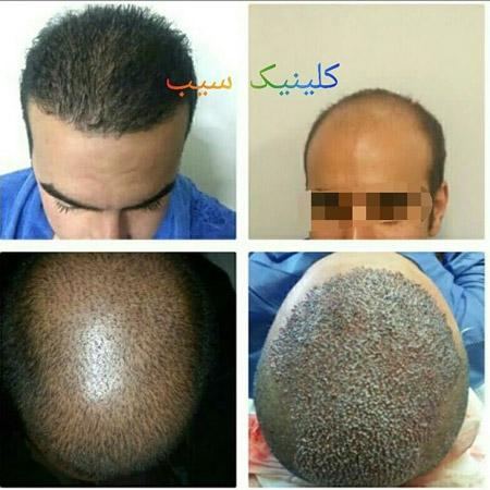 الصور عيادة سیب شیراز الصور عيادة سیب شیراز