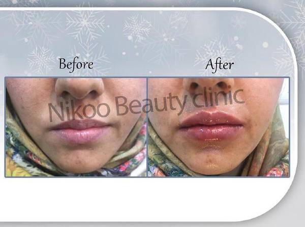 الصور عيادة نیکو شیراز الصور عيادة نیکو شیراز