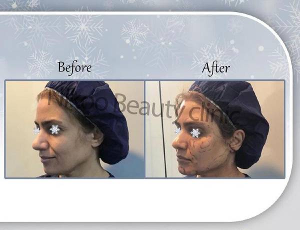 الصور عيادة نیکو شیراز الصور عيادة نیکو شیراز