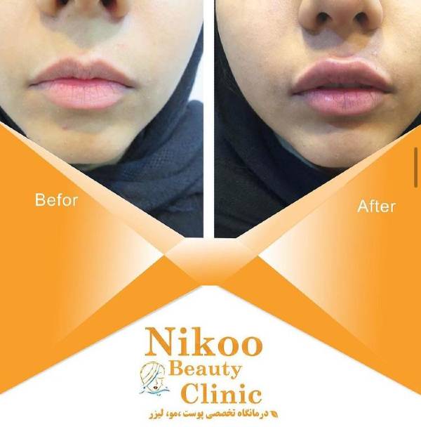 الصور عيادة نیکو شیراز الصور عيادة نیکو شیراز